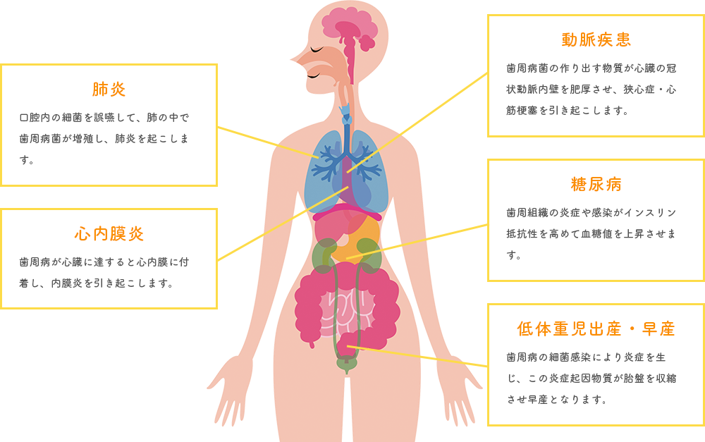 元住吉の歯医者で歯周病治療